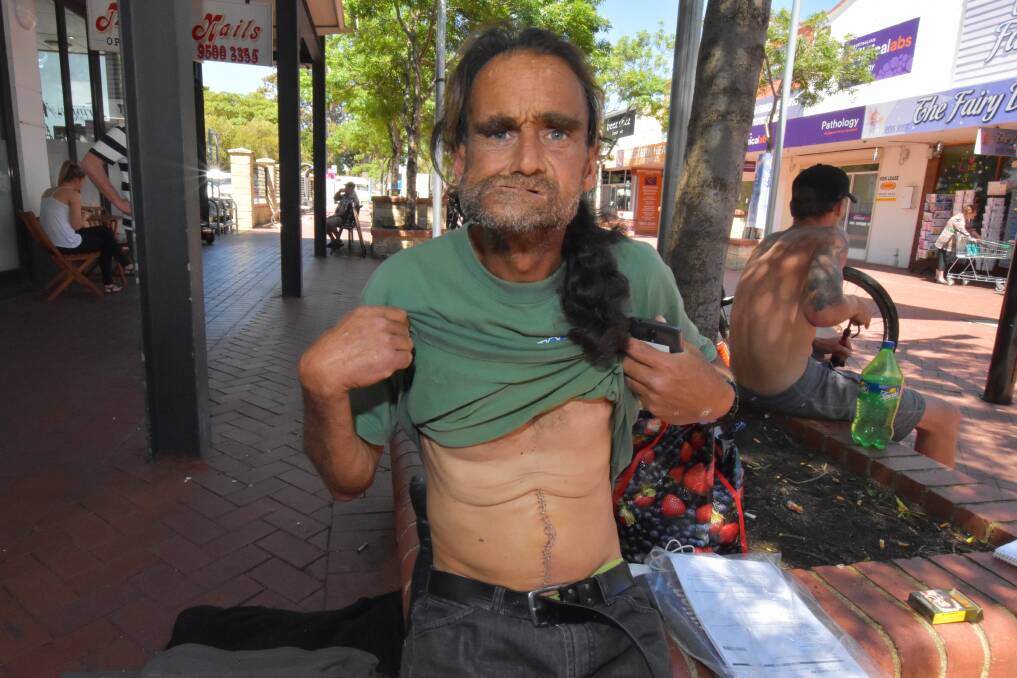 Stitched up: Homeless man Dave shows off his fresh surgery scars. Timba stayed with a volunteer while Dave was in hospital. Photo: Nathan Hondros.
