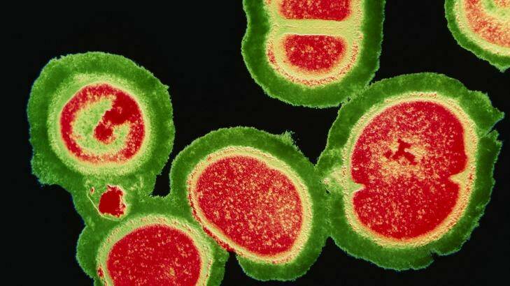 A coloured transmission electron micrograph of a deadly cluster of resistant staphylococcus bacteria. Photo: Science Photo Library