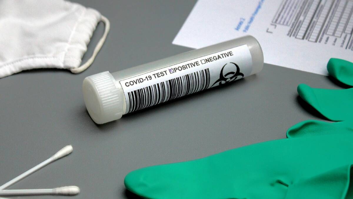 TESTS: Swabs are taken from the throat and nose in COVID-19 tests.