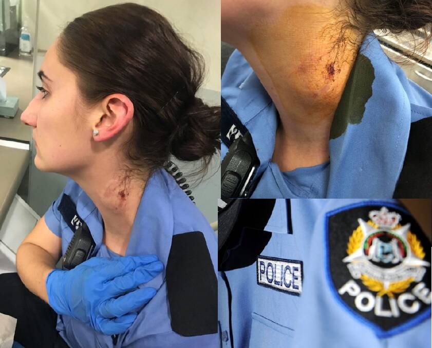 In June this year, this Mandurah Police officer was allegedly bitten on her neck by an 18-year-old Halls Head woman in custody, at the Mandurah Police Station. 