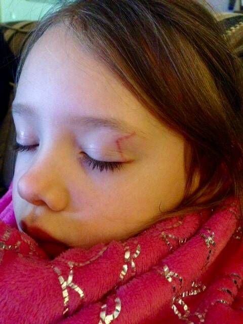 LUCKY ESCAPE: Maddison Duggan, 6, received a scratch on her eyelid after being swooped by a magpie. Photo: Supplied.