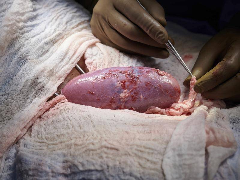 A successful pig-to-human kidney transplant test spells hope for those on lengthy organ wait lists.